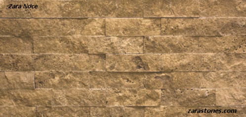 Zara Noce Veneers